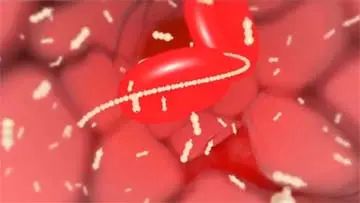 Fondaparinux Arixtra Medication Patient Information video thumbnail