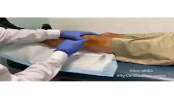 Sodium Hyaluronate Hylasto One Medication Patient Information video thumbnail