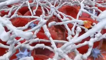 Aprotinin Fibrinogen Thrombin Artiss Tisseel Medication Patient Information video thumbnail