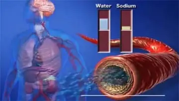Conivaptan Vaprisol Medication Patient Information video thumbnail
